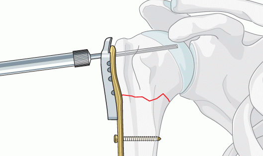 ҽ�ƹ���Ǿ�